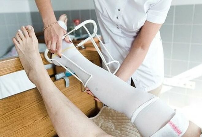 Perioada postoperatorie de la operație pe venele picioarelor